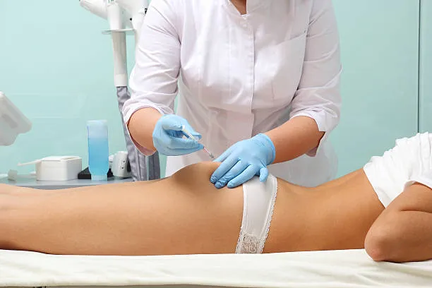 Bioestimuladores de colágeno para flacidez