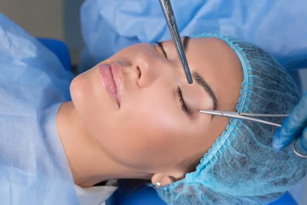 Laser para palpebras caidas