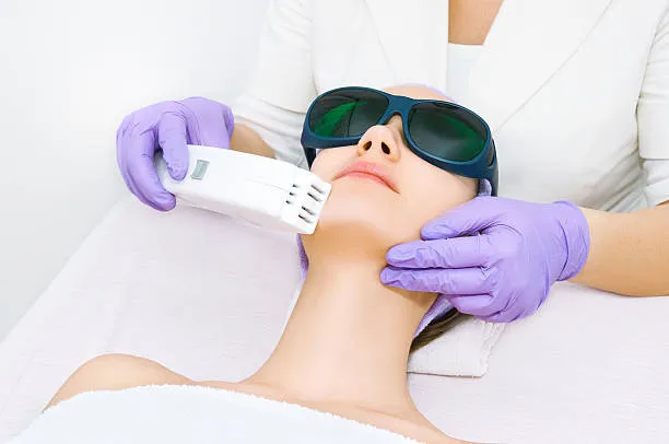 Laser para rejuvenescimento do rosto