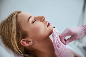 Preenchimento labial com ácido hialurônico