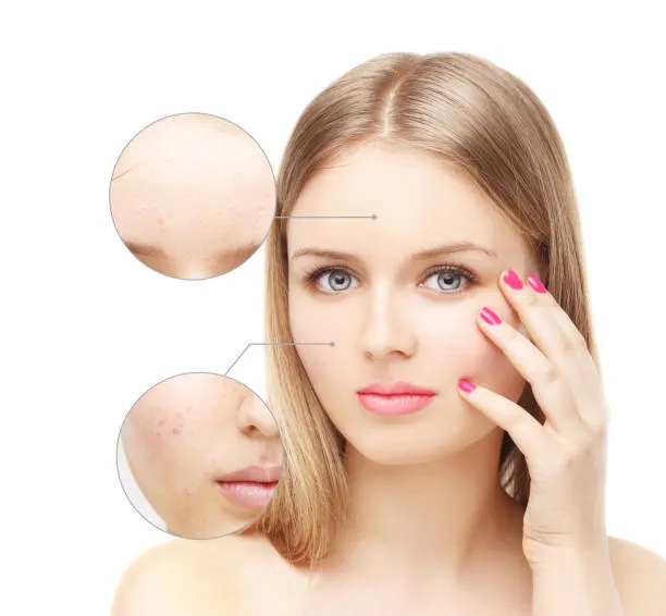 Ultrassom microfocado full face em São Paulo