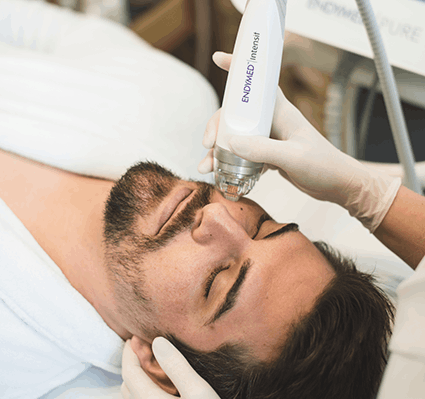 Tratamento para cicatrizes de acne Ak Dermatologia