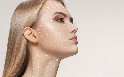 Fios de PDO Ak Dermatologia