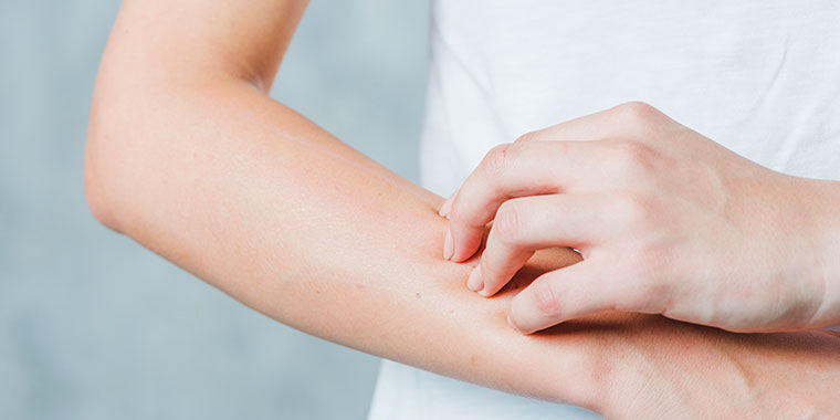 Dermatites alérgicas e não alérgicas Ak Dermatologia